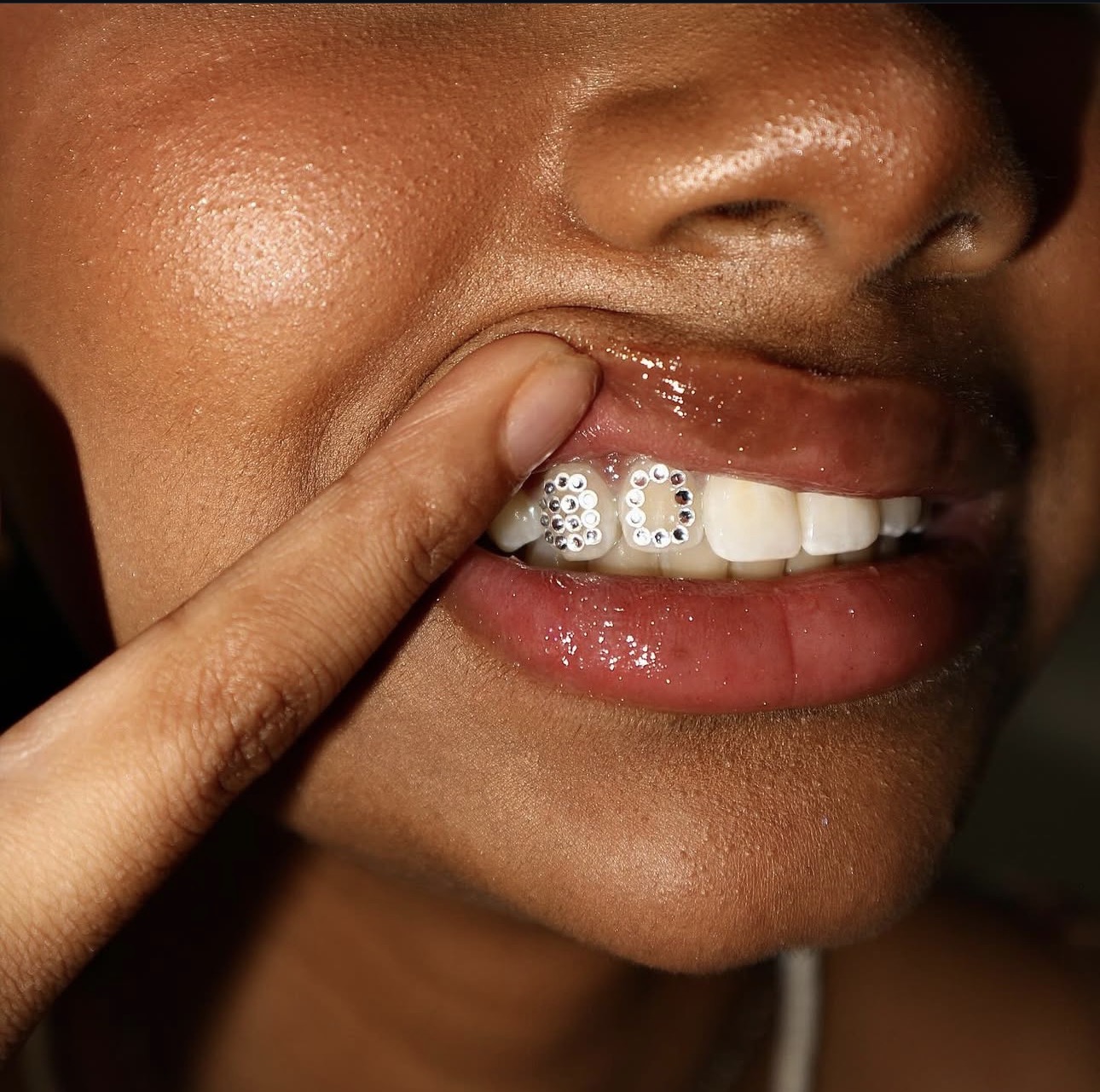 Toothgems resultaat 1